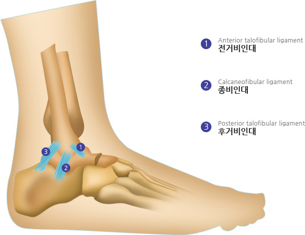 1:Anterior talofibular ligament 전거비인대,2:Calcaneofibular ligament 종비인대,3:Posterior talofibular ligament 후거비인대